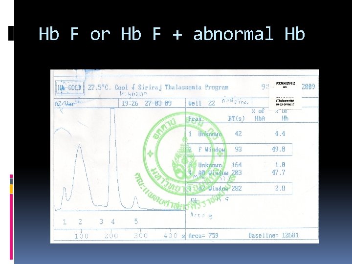 Hb F or Hb F + abnormal Hb 