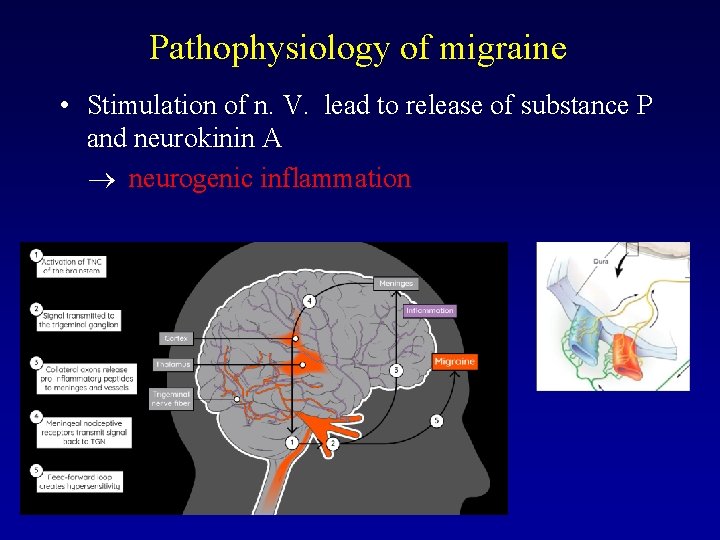 Pathophysiology of migraine • Stimulation of n. V. lead to release of substance P