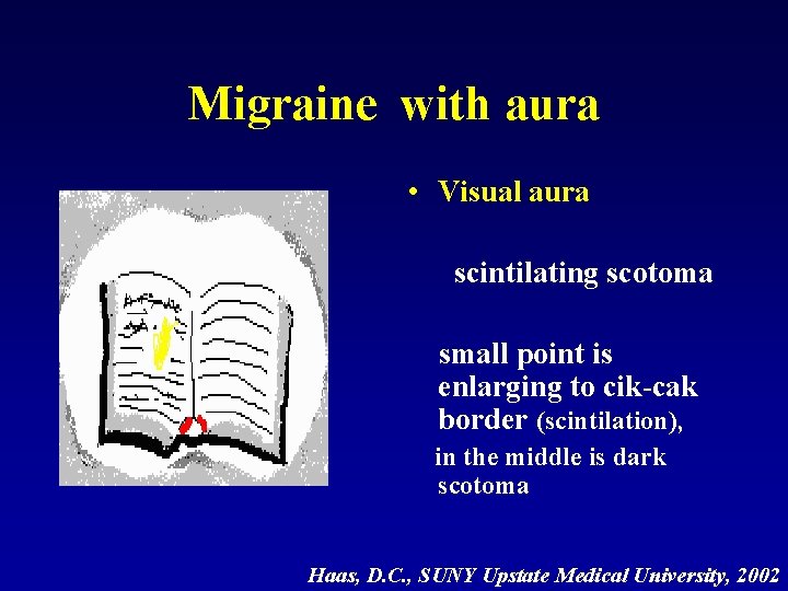 Migraine with aura • Visual aura scintilating scotoma small point is enlarging to cik-cak
