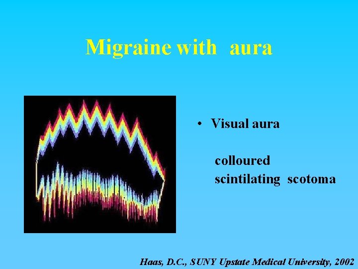 Migraine with aura • Visual aura colloured scintilating scotoma Haas, D. C. , SUNY