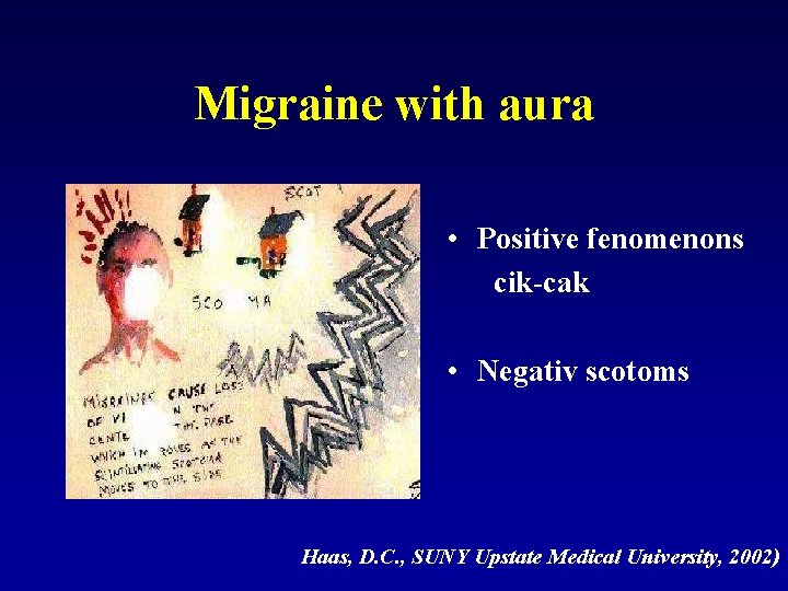 Migraine with aura • Positive fenomenons cik-cak • Negativ scotoms Haas, D. C. ,