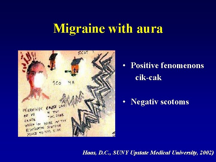 Migraine with aura • Positive fenomenons cik-cak • Negativ scotoms Haas, D. C. ,