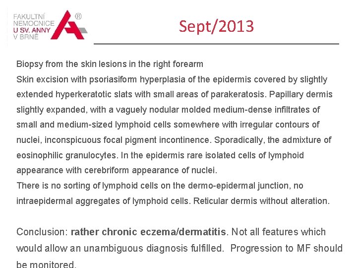 Sept/2013 Biopsy from the skin lesions in the right forearm Skin excision with psoriasiform