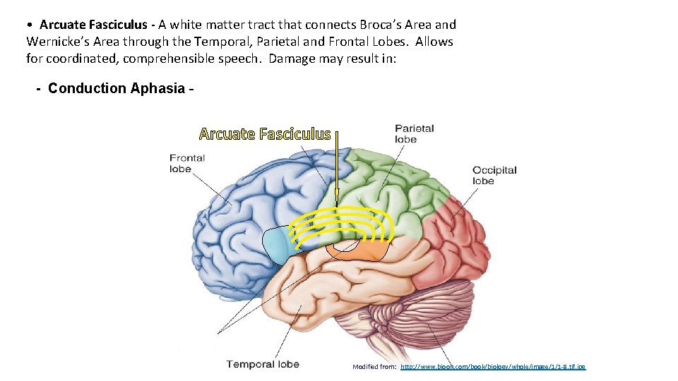  • Arcuate Fasciculus - A white matter tract that connects Broca’s Area and