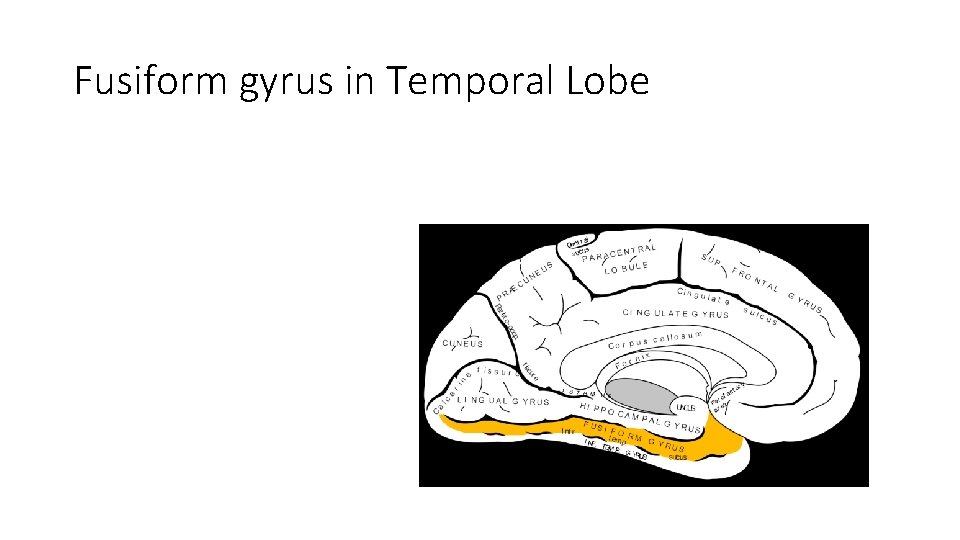 Fusiform gyrus in Temporal Lobe 