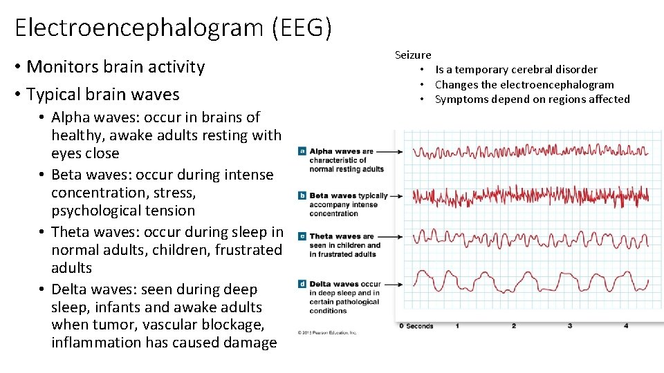 Electroencephalogram (EEG) • Monitors brain activity • Typical brain waves • Alpha waves: occur