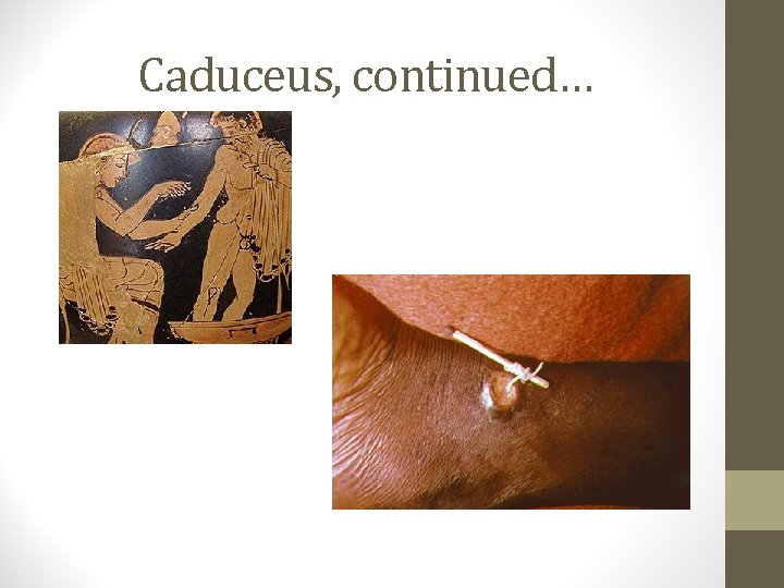 Caduceus, continued… 