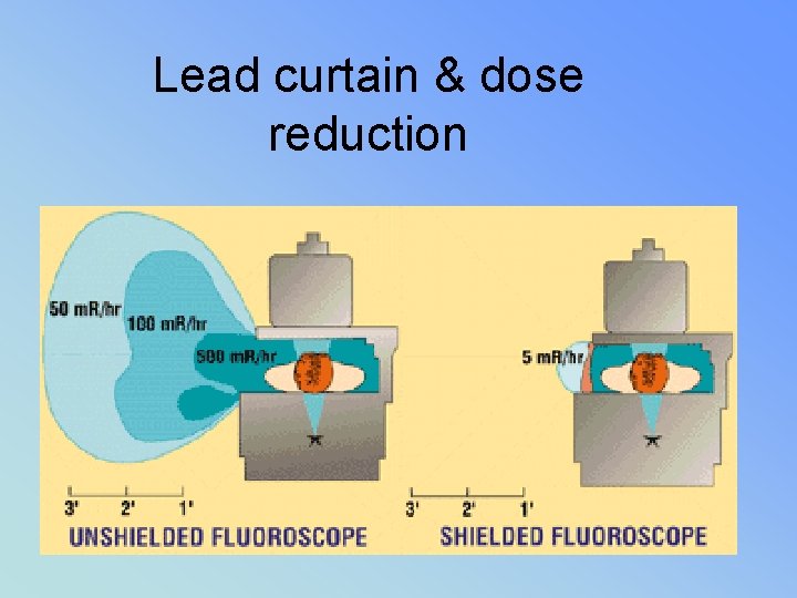 Lead curtain & dose reduction 