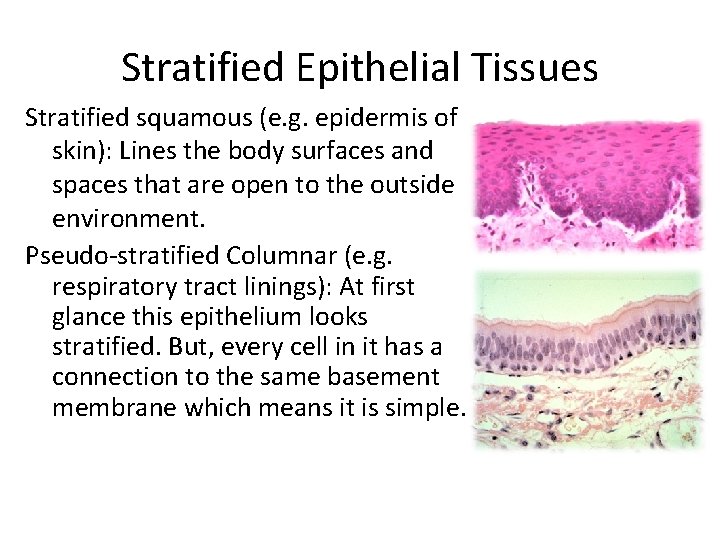 Stratified Epithelial Tissues Stratified squamous (e. g. epidermis of skin): Lines the body surfaces Stratified Epithelial Tissues Stratified squamous (e. g. epidermis of skin): Lines the body surfaces