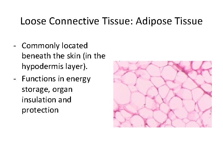 Loose Connective Tissue: Adipose Tissue - Commonly located beneath the skin (in the hypodermis Loose Connective Tissue: Adipose Tissue - Commonly located beneath the skin (in the hypodermis
