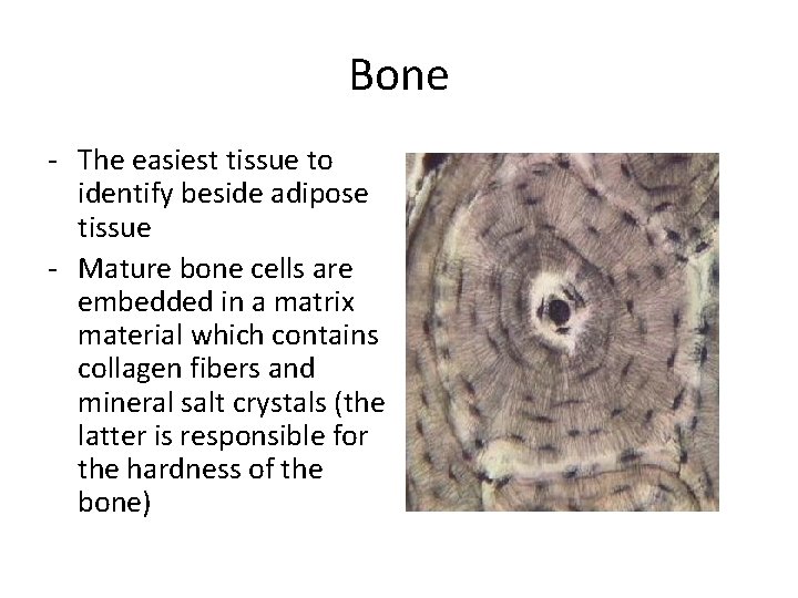 Bone - The easiest tissue to identify beside adipose tissue - Mature bone cells Bone - The easiest tissue to identify beside adipose tissue - Mature bone cells