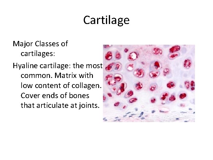 Cartilage Major Classes of cartilages: Hyaline cartilage: the most common. Matrix with low content Cartilage Major Classes of cartilages: Hyaline cartilage: the most common. Matrix with low content