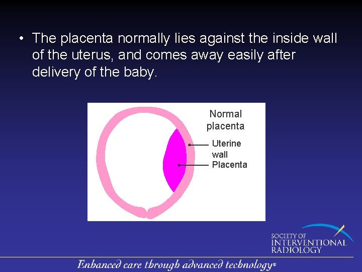  • The placenta normally lies against the inside wall of the uterus, and