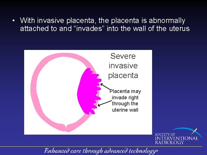  • With invasive placenta, the placenta is abnormally attached to and “invades” into