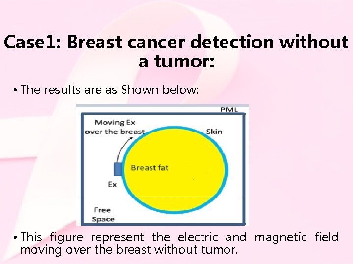 Case 1: Breast cancer detection without a tumor: • The results are as Shown