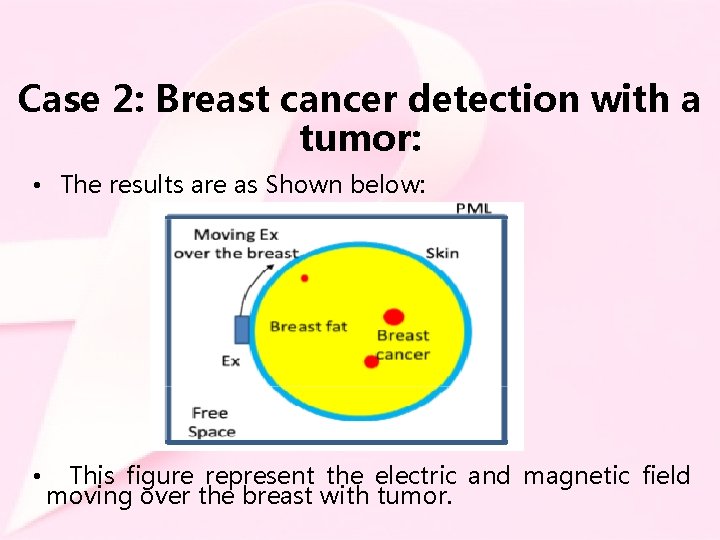 Case 2: Breast cancer detection with a tumor: • The results are as Shown