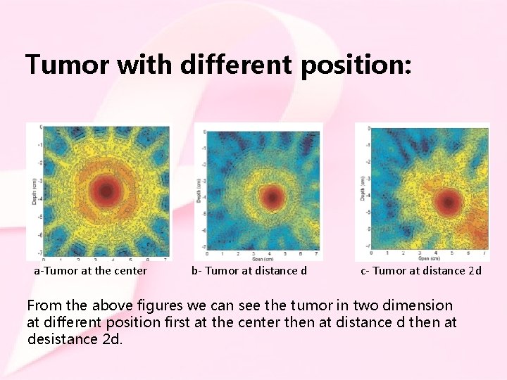 Tumor with different position: a-Tumor at the center b- Tumor at distance d c-