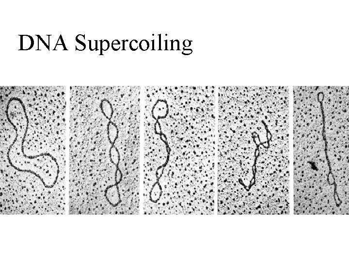 DNA Supercoiling 