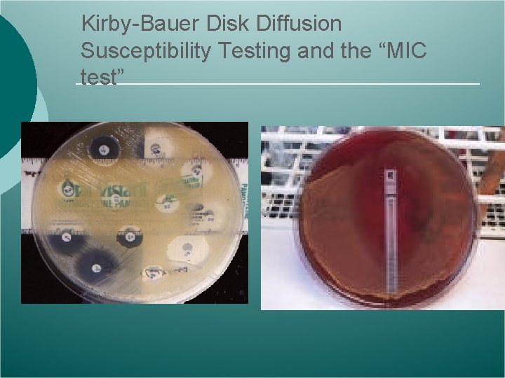 Kirby-Bauer Disk Diffusion Susceptibility Testing and the “MIC test” 