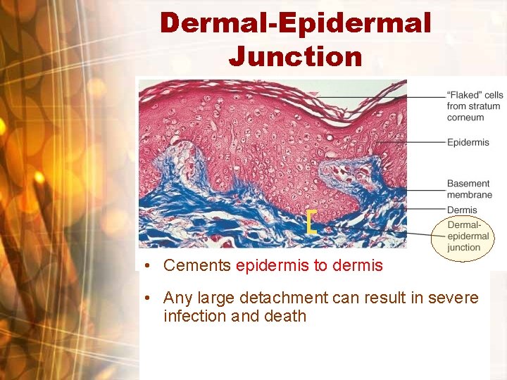 Dermal-Epidermal Junction • Cements epidermis to dermis • Any large detachment can result in Dermal-Epidermal Junction • Cements epidermis to dermis • Any large detachment can result in