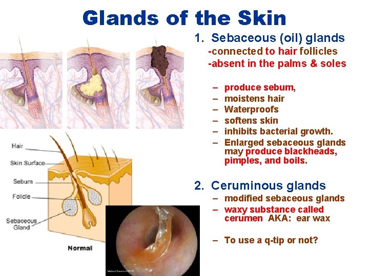 Glands of the Skin 1. Sebaceous (oil) glands -connected to hair follicles -absent in Glands of the Skin 1. Sebaceous (oil) glands -connected to hair follicles -absent in