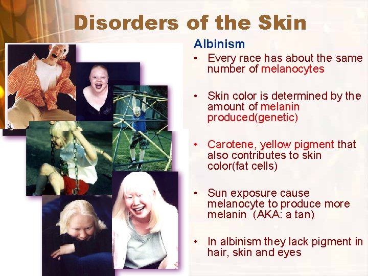 Disorders of the Skin Albinism • Every race has about the same number of Disorders of the Skin Albinism • Every race has about the same number of