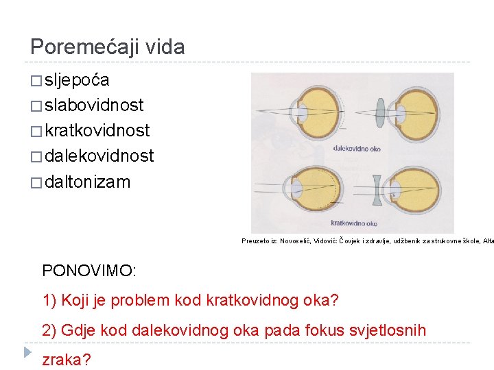 Poremećaji vida � sljepoća � slabovidnost � kratkovidnost � dalekovidnost � daltonizam Preuzeto iz: Poremećaji vida � sljepoća � slabovidnost � kratkovidnost � dalekovidnost � daltonizam Preuzeto iz:
