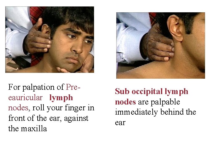 For palpation of Preeauricular lymph nodes, roll your finger in front of the ear,