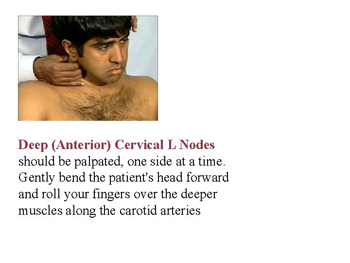 Deep (Anterior) Cervical L Nodes should be palpated, one side at a time. Gently