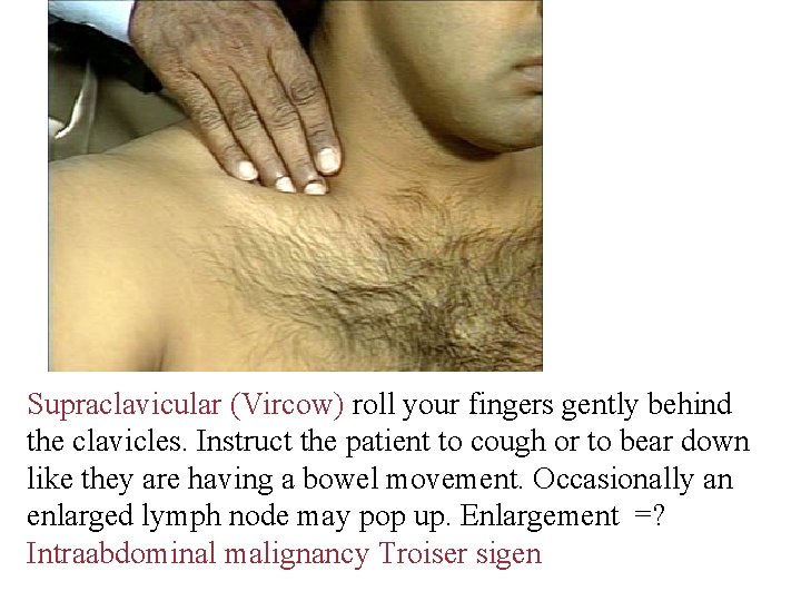 Supraclavicular (Vircow) roll your fingers gently behind the clavicles. Instruct the patient to cough