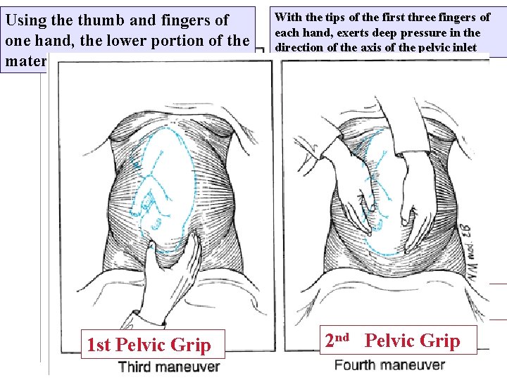 Using the thumb and fingers of one hand, the lower portion of the maternal