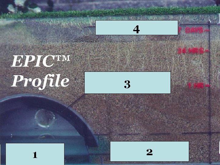 4 Dry mold free crown zone EPIC™ Profile 1 Chamber Capillary Zone (note root