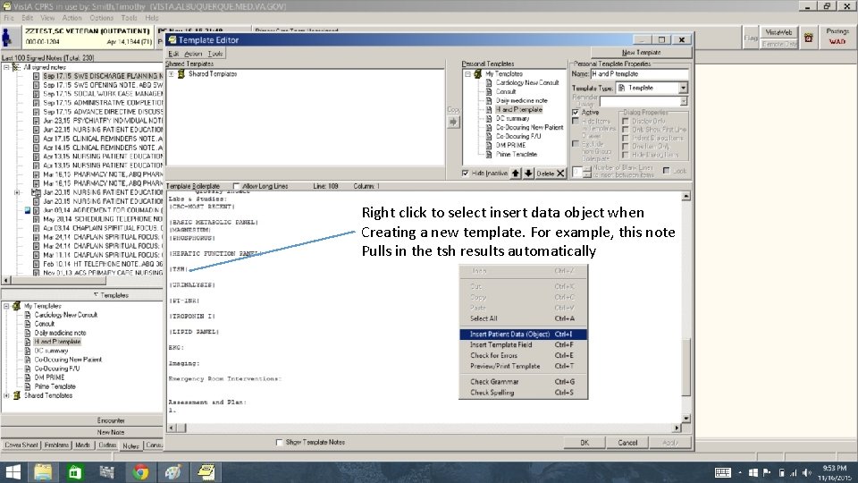Right click to select insert data object when Creating a new template. For example,
