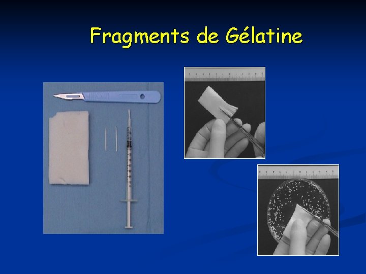 Fragments de Gélatine 