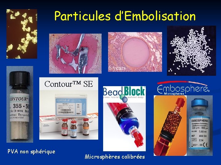 Particules d’Embolisation Contour™ SE PVA non sphérique Microsphères calibrées 