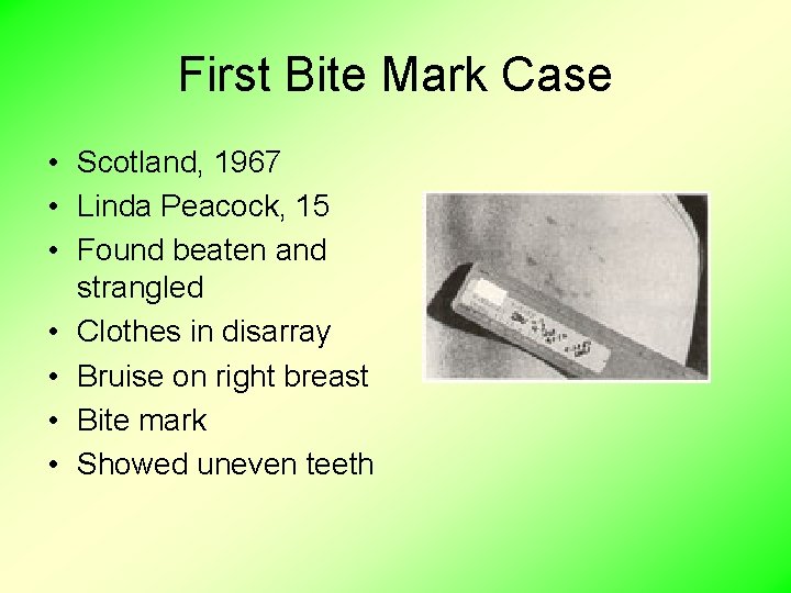 First Bite Mark Case • Scotland, 1967 • Linda Peacock, 15 • Found beaten