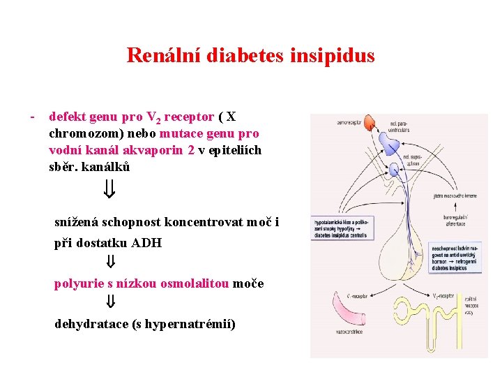Renální diabetes insipidus - defekt genu pro V 2 receptor ( X chromozom) nebo