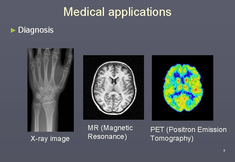 Medical applications ► Diagnosis X-ray image MR (Magnetic Resonance) PET (Positron Emission Tomography) 8