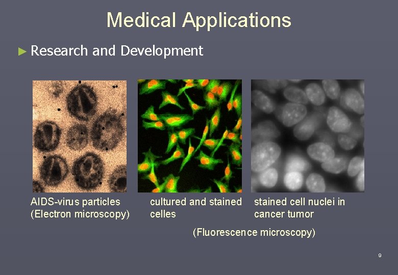 Medical Applications ► Research and Development AIDS-virus particles (Electron microscopy) cultured and stained celles