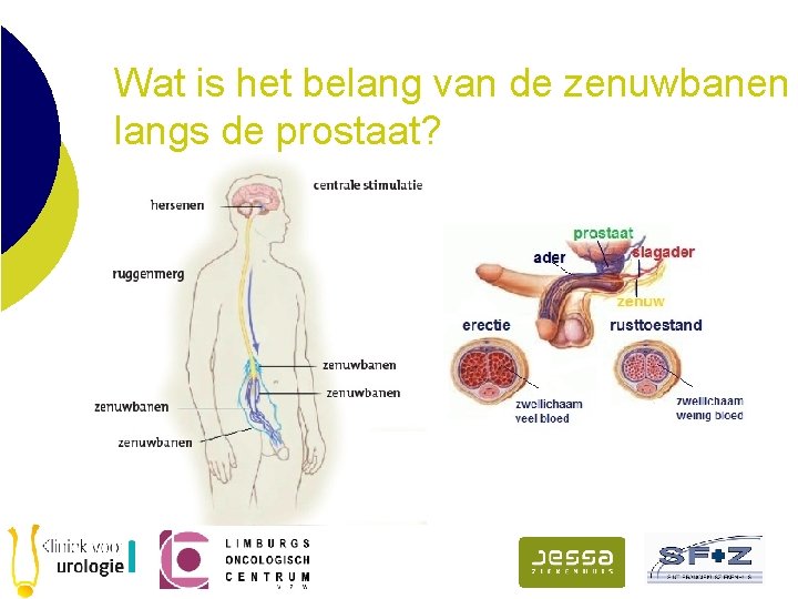 Wat is het belang van de zenuwbanen langs de prostaat? 