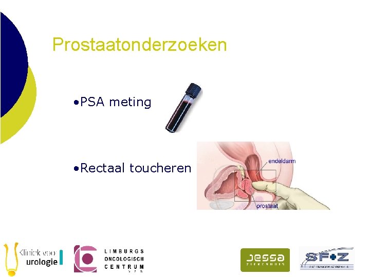 Prostaatonderzoeken • PSA meting • Rectaal toucheren 