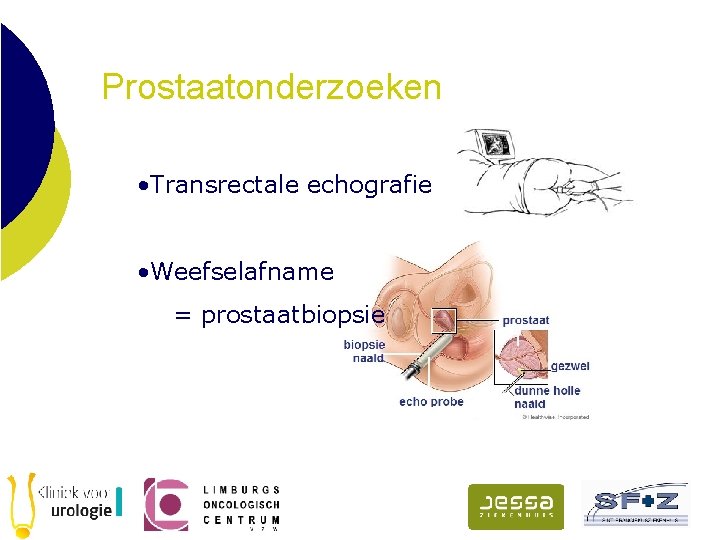 Prostaatonderzoeken • Transrectale echografie • Weefselafname = prostaatbiopsie 