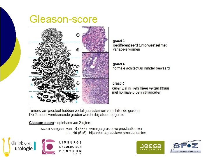Gleason-score 