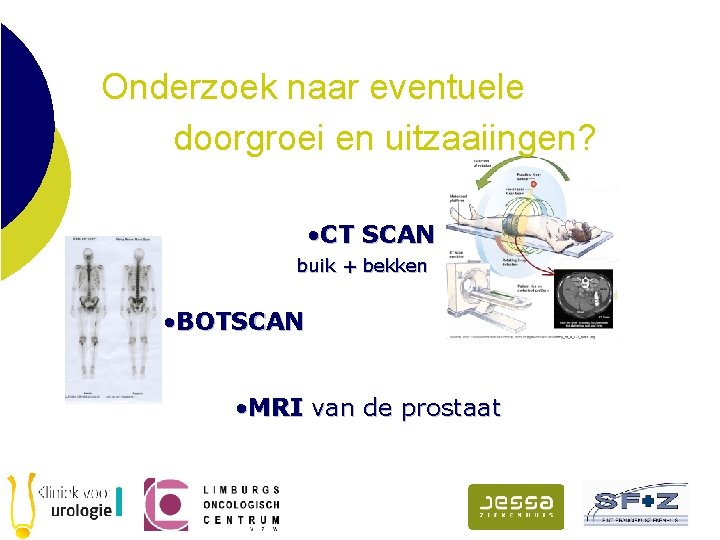 Onderzoek naar eventuele doorgroei en uitzaaiingen? • CT SCAN buik + bekken • BOTSCAN