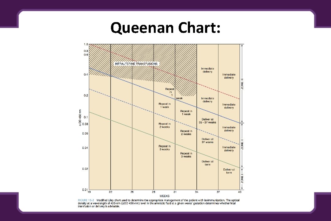 Queenan Chart: 