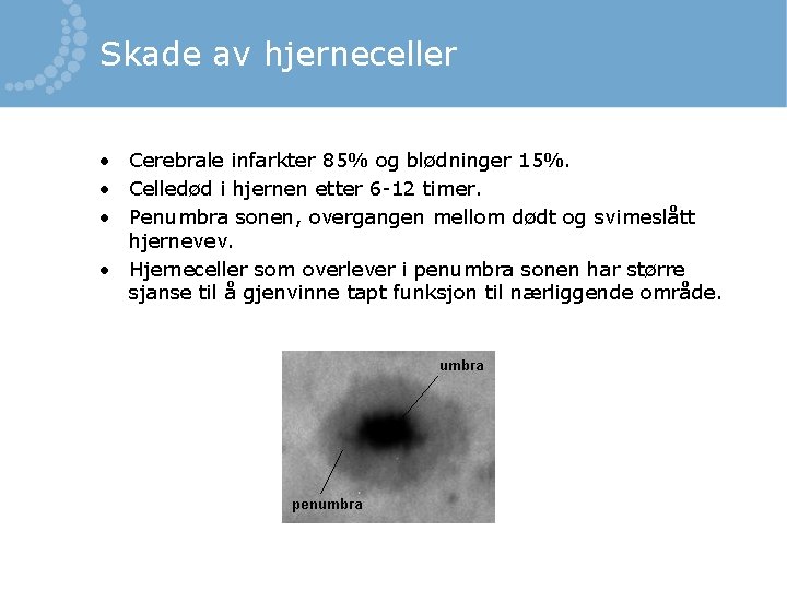 Skade av hjerneceller • Cerebrale infarkter 85% og blødninger 15%. • Celledød i hjernen