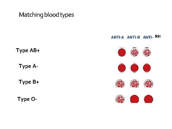 Matching blood types RH Type AB+ Type AType B+ Type O- 