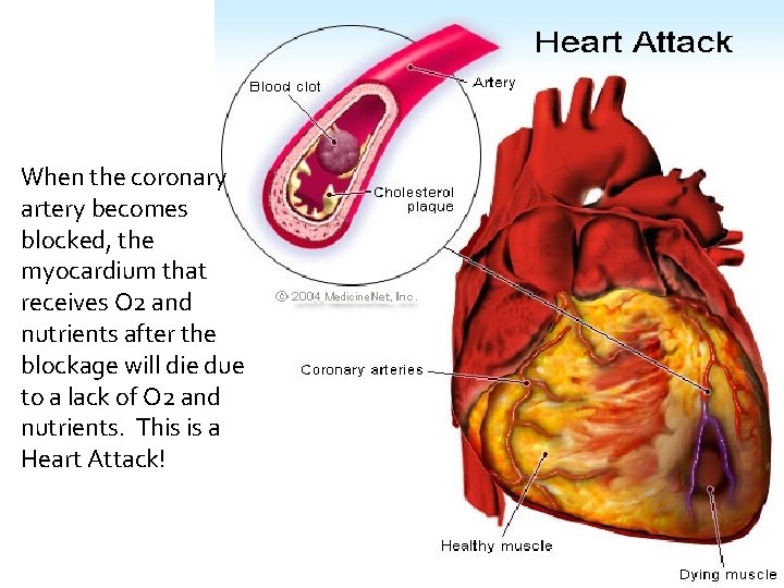 When the coronary artery becomes blocked, the myocardium that receives O 2 and nutrients