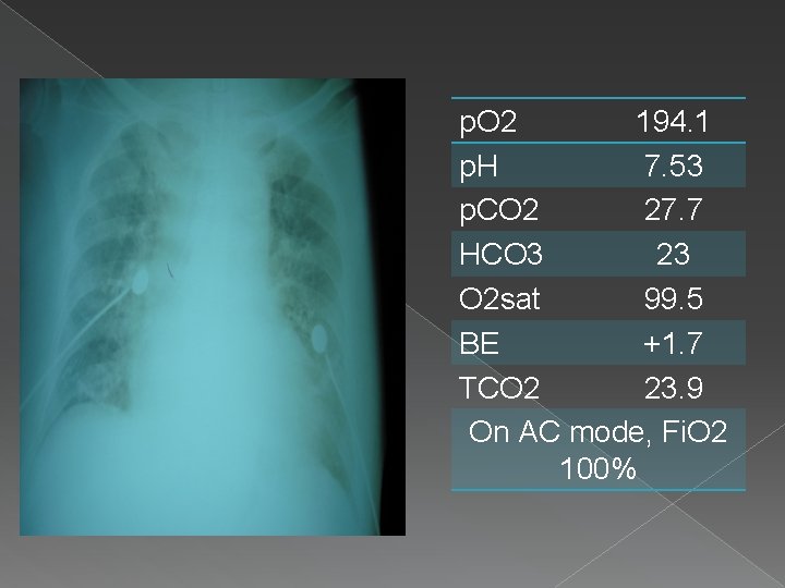 p. O 2 194. 1 p. H 7. 53 p. CO 2 27. 7