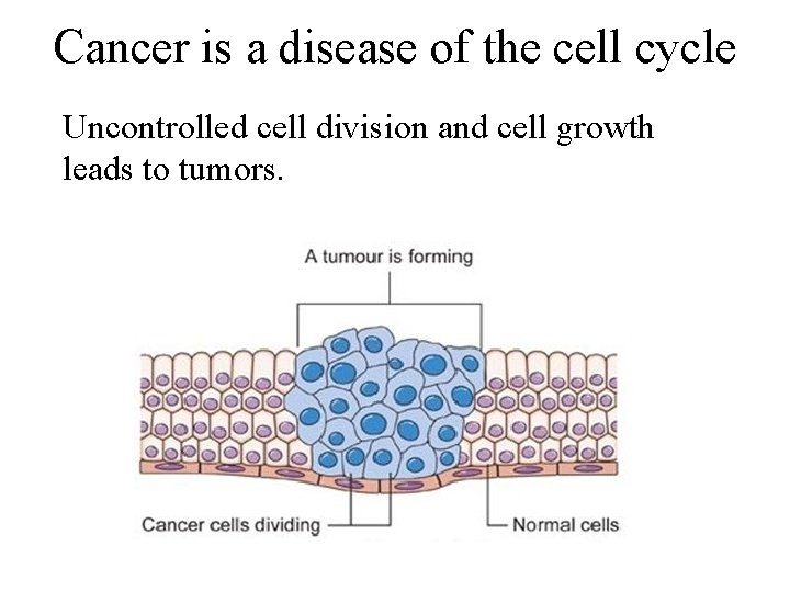 Cancer is a disease of the cell cycle Uncontrolled cell division and cell growth